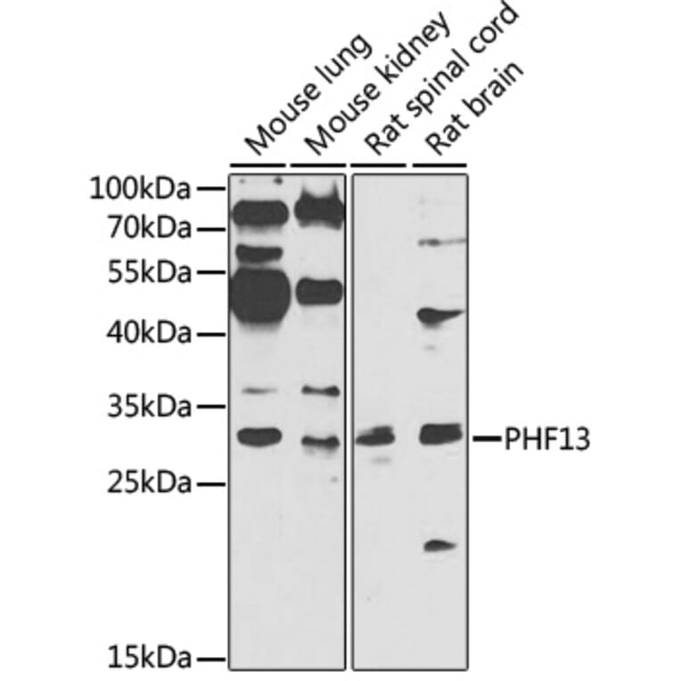 Western Blot - Anti-PHF13 Antibody (A7854) - Antibodies.com