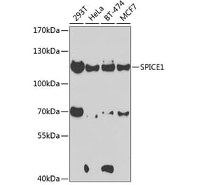 Western Blot - Anti-CCDC52 Antibody (A15933) - Antibodies.com