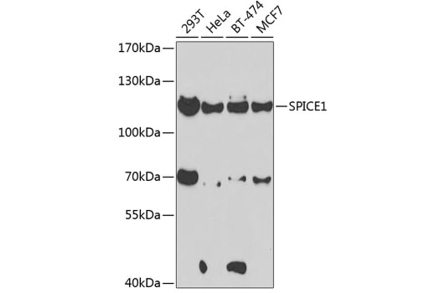 Western Blot - Anti-CCDC52 Antibody (A15933) - Antibodies.com