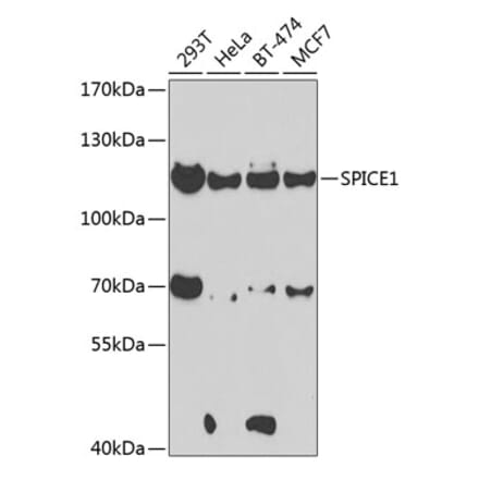 Western Blot - Anti-CCDC52 Antibody (A15933) - Antibodies.com