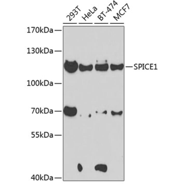 Western Blot - Anti-CCDC52 Antibody (A15933) - Antibodies.com