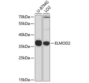 Western Blot - Anti-ELMOD2 Antibody (A15934) - Antibodies.com