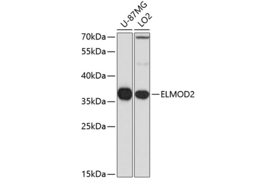 Western Blot - Anti-ELMOD2 Antibody (A15934) - Antibodies.com