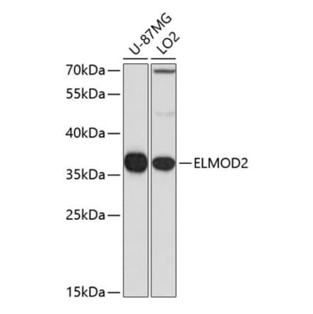 Western Blot - Anti-ELMOD2 Antibody (A15934) - Antibodies.com