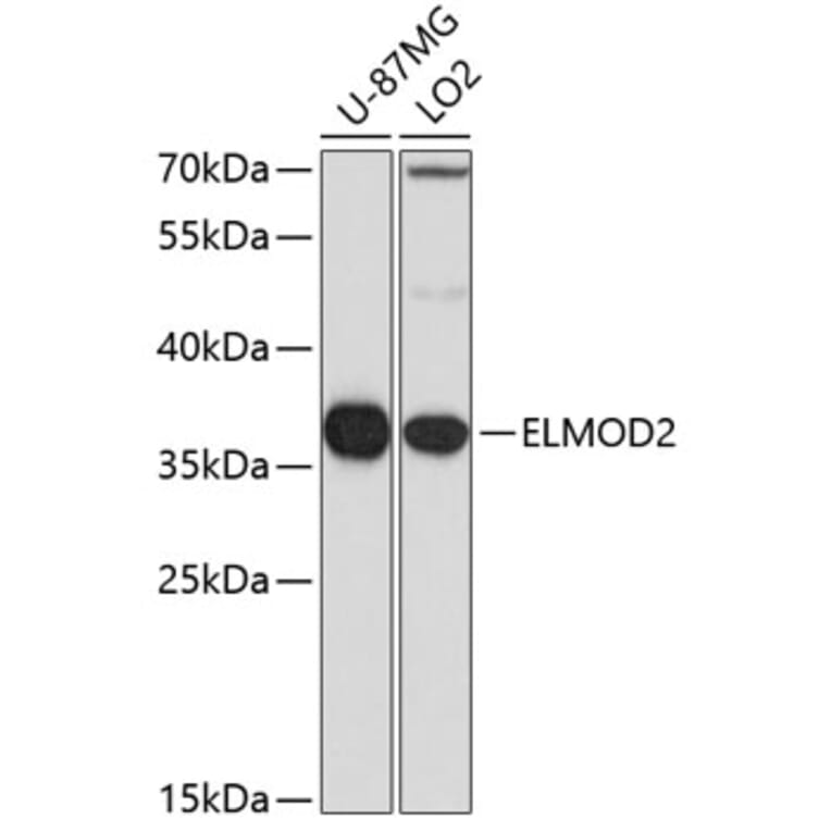Western Blot - Anti-ELMOD2 Antibody (A15934) - Antibodies.com