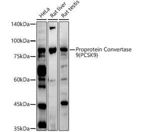 Western Blot - Anti-PCSK9 Antibody (A15935) - Antibodies.com