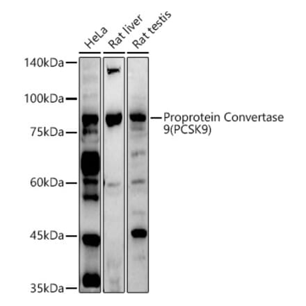 Western Blot - Anti-PCSK9 Antibody (A15935) - Antibodies.com