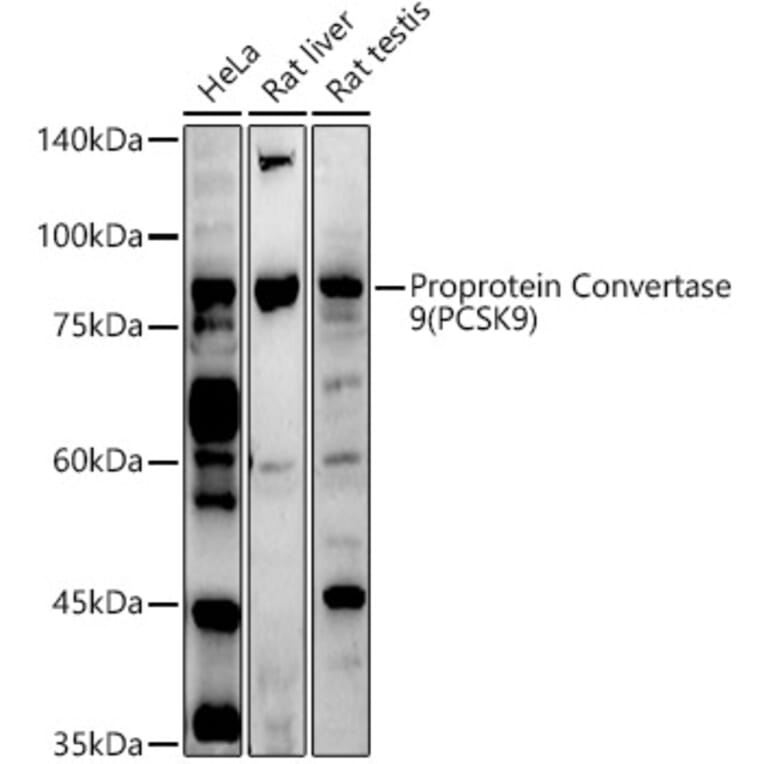 Western Blot - Anti-PCSK9 Antibody (A15935) - Antibodies.com