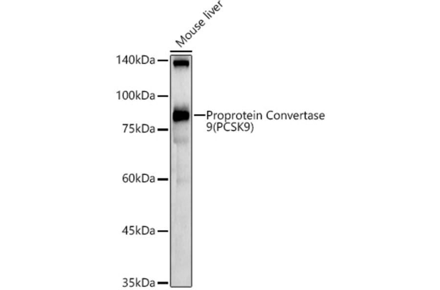 Western Blot - Anti-PCSK9 Antibody (A15935) - Antibodies.com