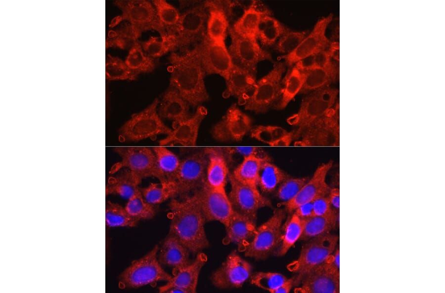 Immunofluorescence - Anti-PCSK9 Antibody (A15935) - Antibodies.com
