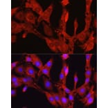 Immunofluorescence - Anti-PCSK9 Antibody (A15935) - Antibodies.com