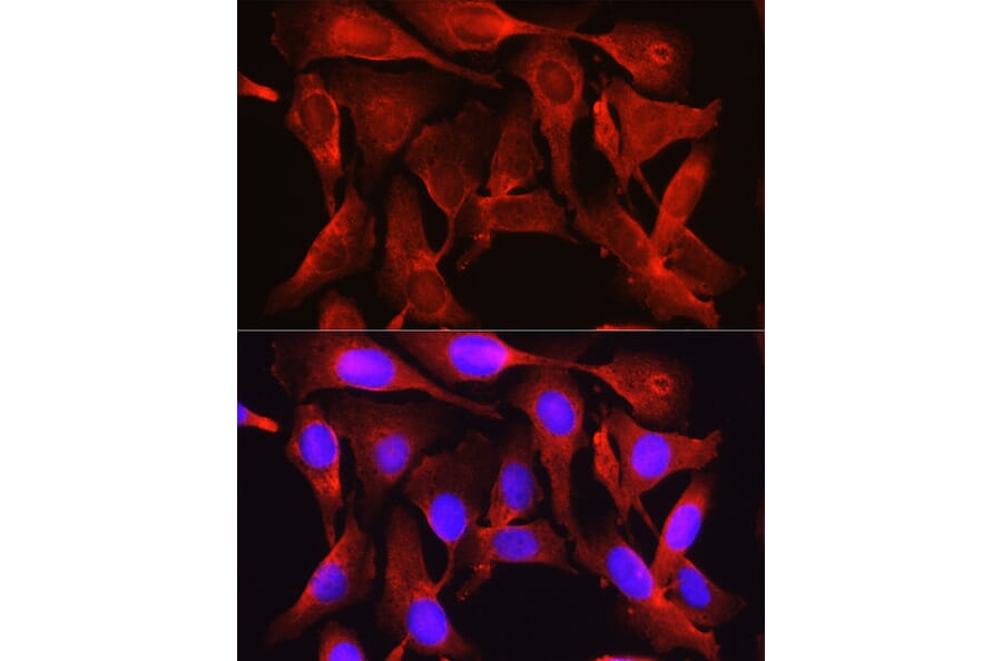 Immunofluorescence - Anti-PCSK9 Antibody (A15935) - Antibodies.com
