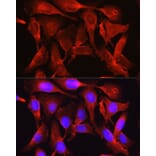 Immunofluorescence - Anti-PCSK9 Antibody (A15935) - Antibodies.com