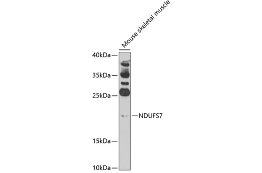 Western Blot - Anti-NDUFS7 Antibody (A7862) - Antibodies.com