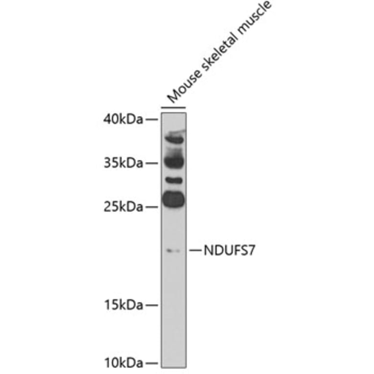 Western Blot - Anti-NDUFS7 Antibody (A7862) - Antibodies.com