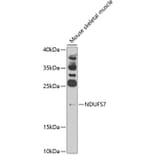 Western Blot - Anti-NDUFS7 Antibody (A7862) - Antibodies.com