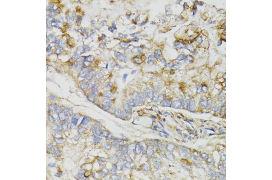 Immunohistochemistry - Anti-NDUFS7 Antibody (A7862) - Antibodies.com