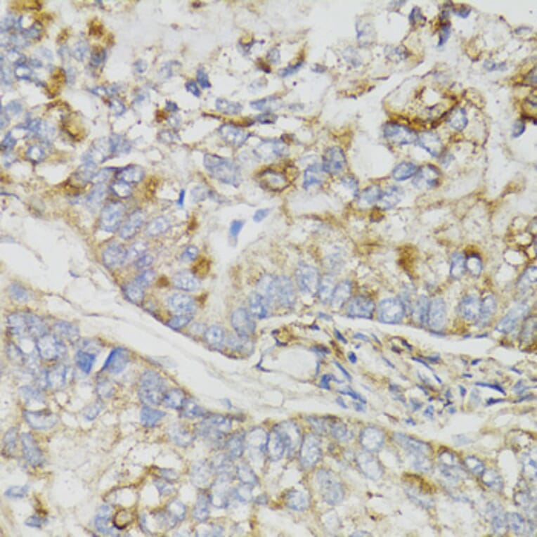 Immunohistochemistry - Anti-NDUFS7 Antibody (A7862) - Antibodies.com