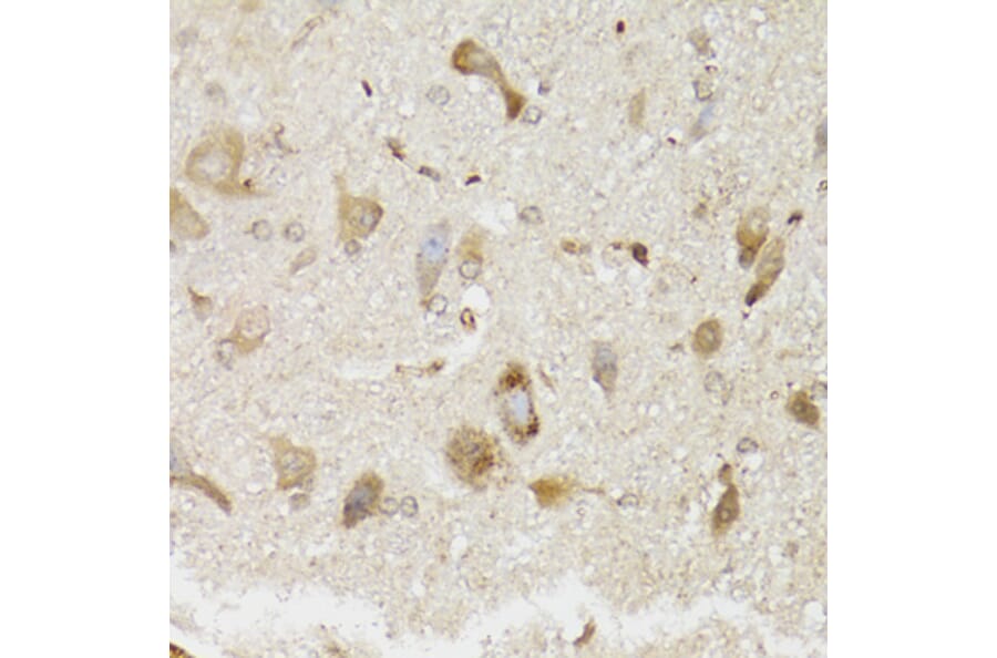 Immunohistochemistry - Anti-NDUFS7 Antibody (A7862) - Antibodies.com