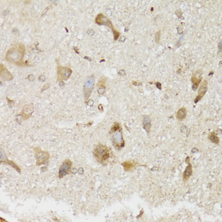 Immunohistochemistry - Anti-NDUFS7 Antibody (A7862) - Antibodies.com