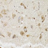 Immunohistochemistry - Anti-NDUFS7 Antibody (A7862) - Antibodies.com