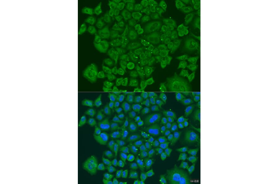 Immunofluorescence - Anti-NDUFS7 Antibody (A7862) - Antibodies.com