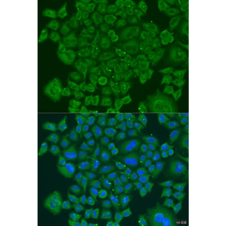 Immunofluorescence - Anti-NDUFS7 Antibody (A7862) - Antibodies.com