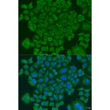 Immunofluorescence - Anti-NDUFS7 Antibody (A7862) - Antibodies.com