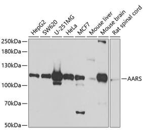 Western Blot - Anti-AARS Antibody (A7864) - Antibodies.com