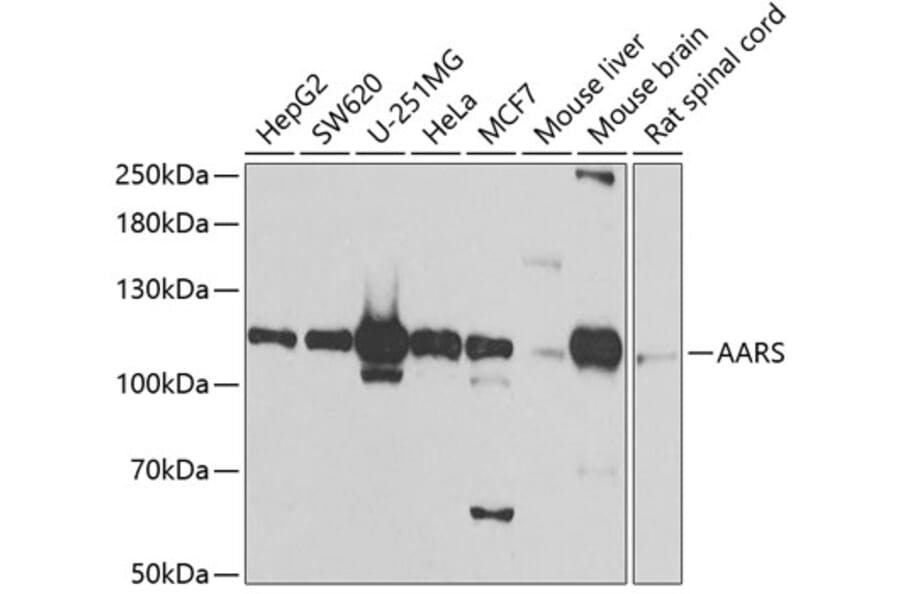 Western Blot - Anti-AARS Antibody (A7864) - Antibodies.com
