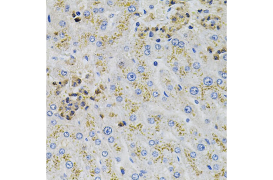 Immunohistochemistry - Anti-AARS Antibody (A7864) - Antibodies.com