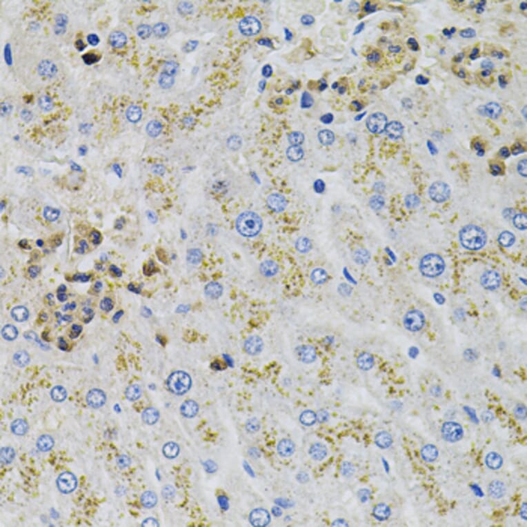 Immunohistochemistry - Anti-AARS Antibody (A7864) - Antibodies.com