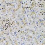 Immunohistochemistry - Anti-AARS Antibody (A7864) - Antibodies.com