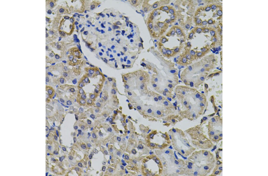 Immunohistochemistry - Anti-AARS Antibody (A7864) - Antibodies.com