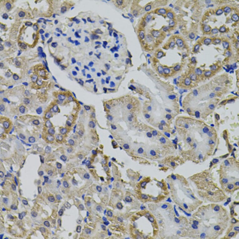 Immunohistochemistry - Anti-AARS Antibody (A7864) - Antibodies.com