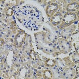 Immunohistochemistry - Anti-AARS Antibody (A7864) - Antibodies.com