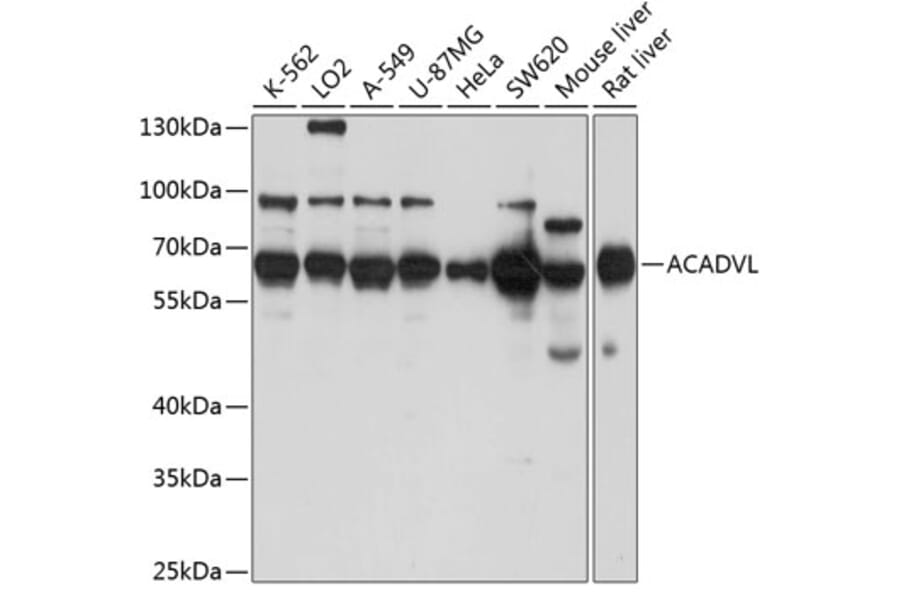 Western Blot - Anti-ACADVL/VLCAD Antibody (A15938) - Antibodies.com