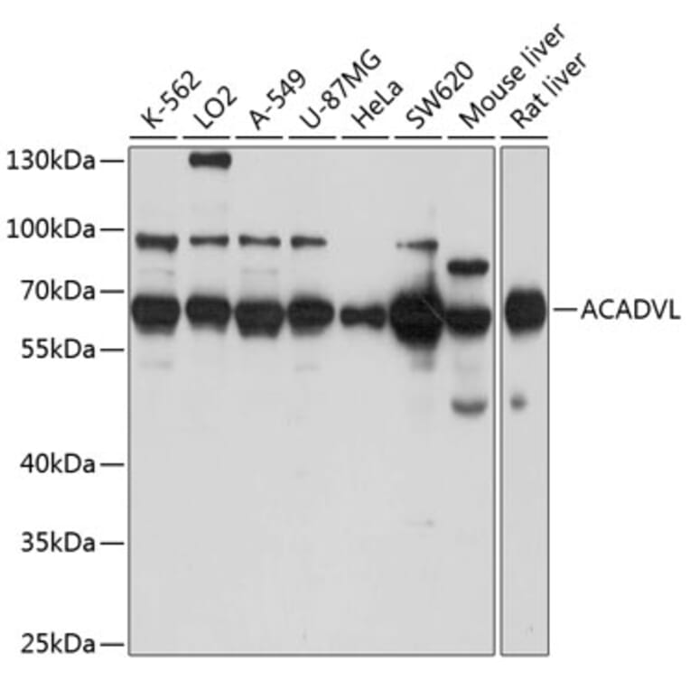 Western Blot - Anti-ACADVL/VLCAD Antibody (A15938) - Antibodies.com