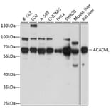 Western Blot - Anti-ACADVL/VLCAD Antibody (A15938) - Antibodies.com