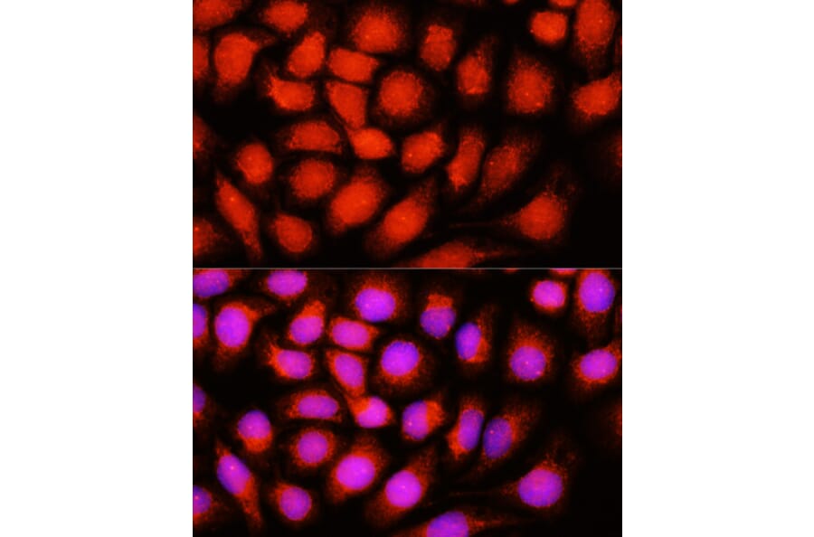 Immunofluorescence - Anti-ACADVL/VLCAD Antibody (A15938) - Antibodies.com
