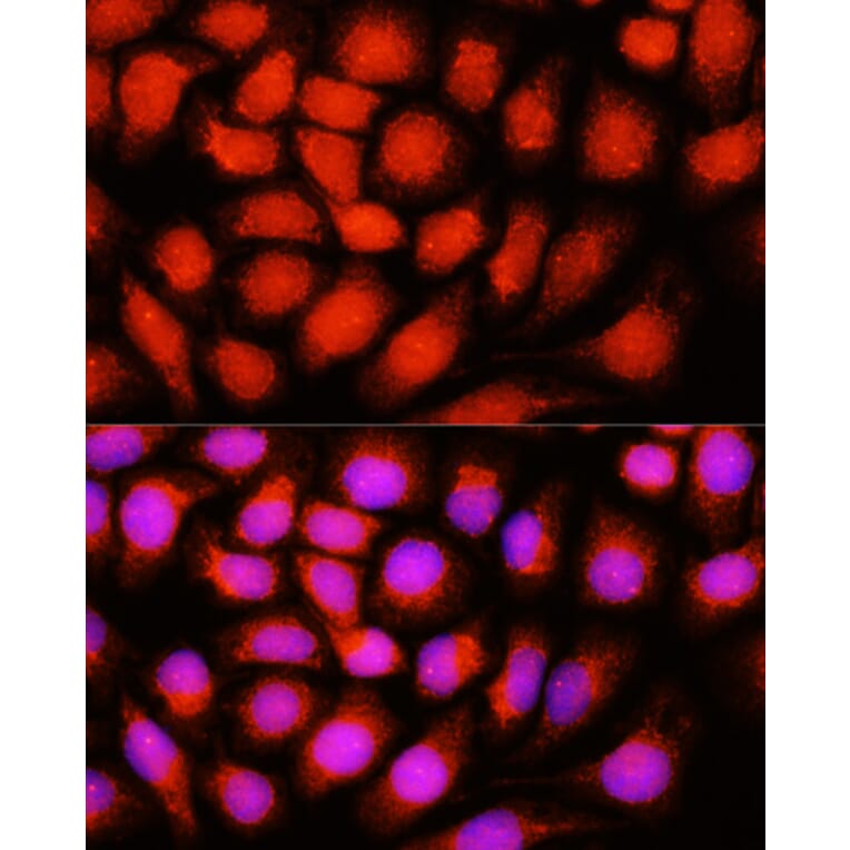 Anti-ACADVL / VLCAD Antibody (A15938) | Antibodies.com