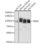 Western Blot - Anti-Aconitase 1 / ACO1 Antibody (A15939) - Antibodies.com