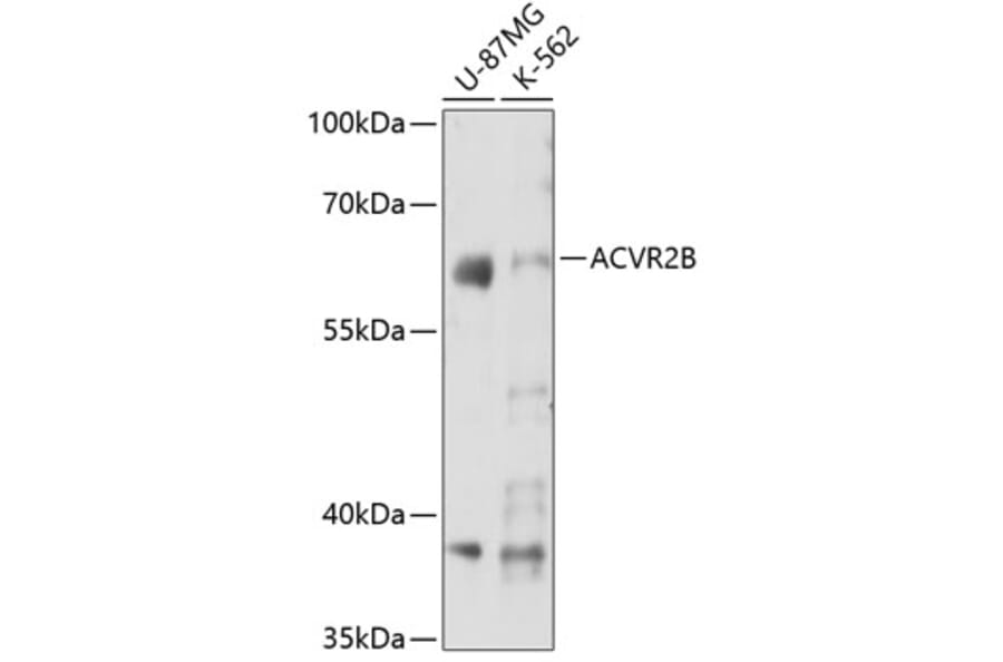 Western Blot - Anti-Activin Receptor Type IIB/ACVR2B Antibody (A15940) - Antibodies.com