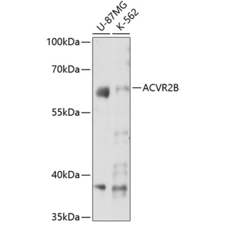 Western Blot - Anti-Activin Receptor Type IIB/ACVR2B Antibody (A15940) - Antibodies.com
