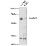 Western Blot - Anti-Activin Receptor Type IIB/ACVR2B Antibody (A15940) - Antibodies.com