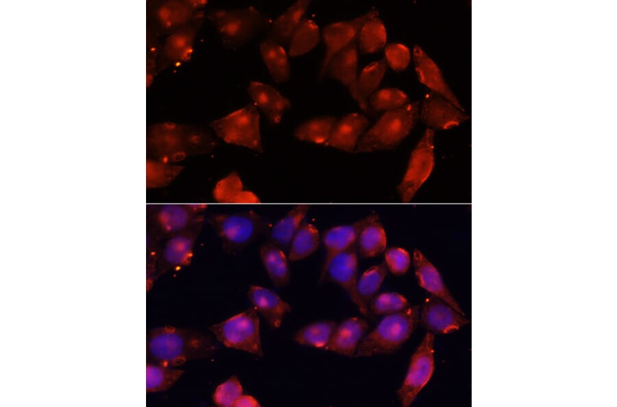 Immunofluorescence - Anti-Activin Receptor Type IIB/ACVR2B Antibody (A15940) - Antibodies.com
