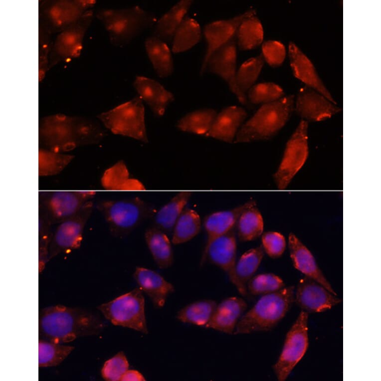 Immunofluorescence - Anti-Activin Receptor Type IIB/ACVR2B Antibody (A15940) - Antibodies.com
