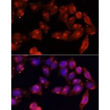 Immunofluorescence - Anti-Activin Receptor Type IIB/ACVR2B Antibody (A15940) - Antibodies.com