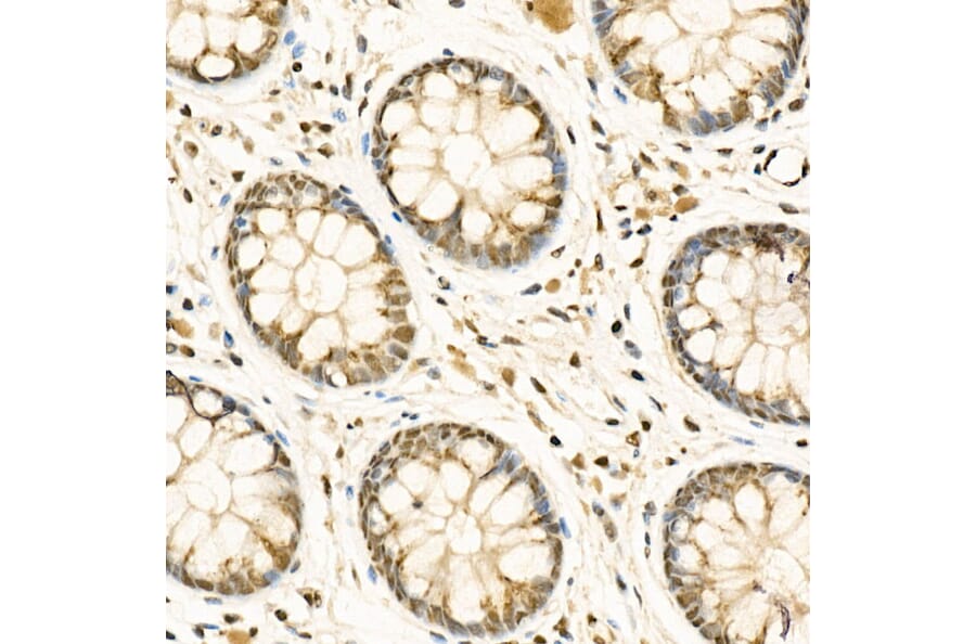 Immunohistochemistry - Anti-ADAR1 Antibody (A15941) - Antibodies.com