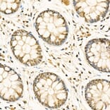 Immunohistochemistry - Anti-ADAR1 Antibody (A15941) - Antibodies.com